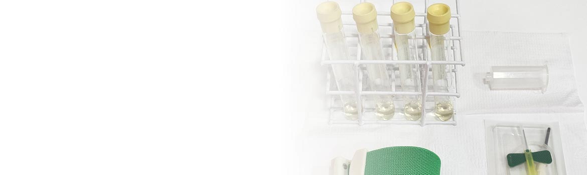 PRP – Plasma Rico em Plaquetas